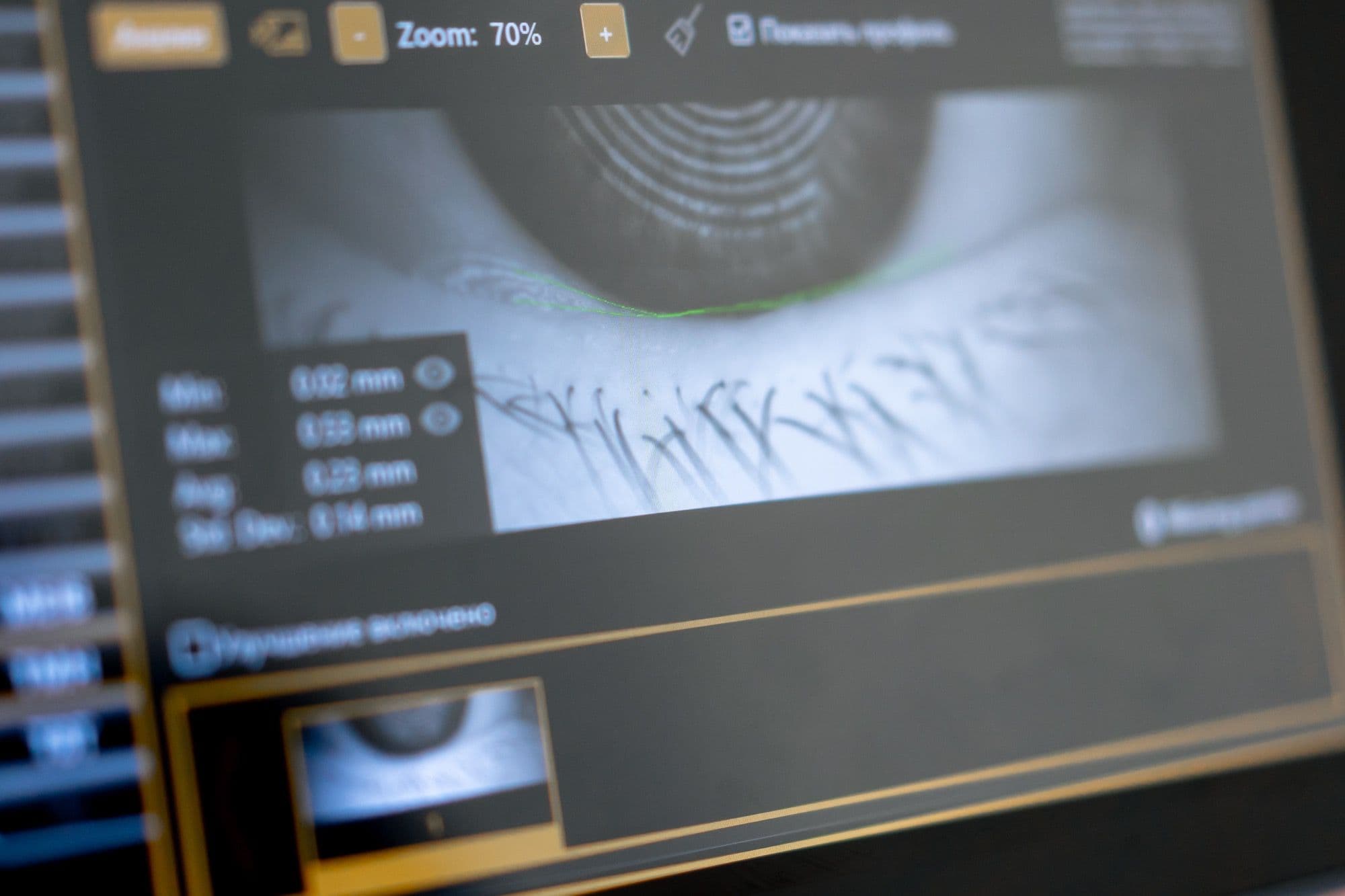 VideoTestimonials vs Vidmonials: Head-to-Head Comparison